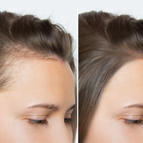 Private Label Hair Growth Oil with Castor, Black Seed & Thyme | U.S. Manufacturer