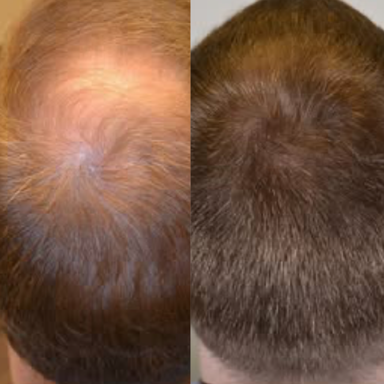 Private Label Hair Growth Oil Sample Kit | U.S. Manufacturer